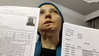 11 yılda 35 kez ameliyat oldu: 3 çocuk annesi kadının dili kesilebilir