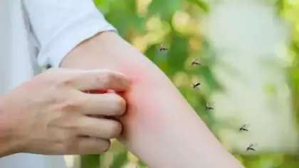 Asya Kaplan Sivrisineği vakaları endişeye yol açtı: Alerjik bünyeye sahipseniz dikkat!
