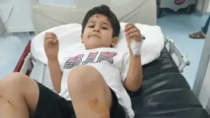 Başıboş köpek saldırısıyla ilgili mülkiye müfettişi görevlendirildi
