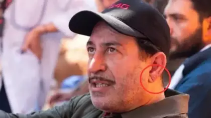 Cem Yılmaz'ın rahatsızlığı sonrası gündem oldu: Kalp krizinin habercisi mi?
