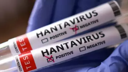 DSÖ'den flaş Hantavirüs salgını açıklaması! Beklenen haber geldi!