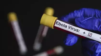 Ebola alarmında 