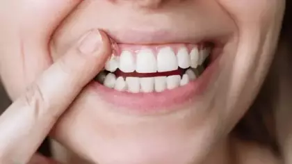 Kanser riskinizi 3 kat birden artırıyor! Her gün yapmayanlar yandı