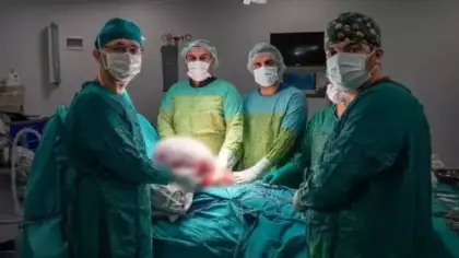 Karın ağrısıyla doktora gitti gerçeği görünce şaşkına döndü! Tam 15 kg çıkarıldı...