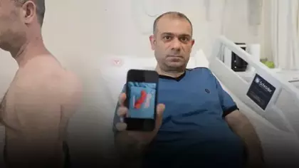 Sırtındaki şişliği önemsemedi! Yıllar içinde büyüdü! Doktorları şoke eden vaka