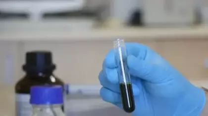 Türk bilim insanlarından kanser hücresini azaltan buluş!